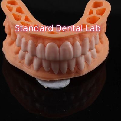 OEM ODM Pop On Veneers Maßgeschneiderte Veneers Snap On Smile
