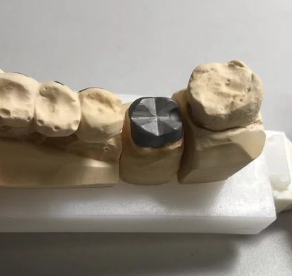 ISO FDA CE Zahnmetallpfosten und Kernkrone PFM Gut geeignet