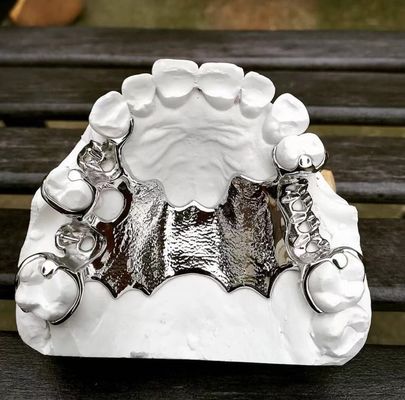 Kobalt-Chrom-Rückgängigmachbares Teilprothesenrahmen Laserdruck Ni Be kostenlos