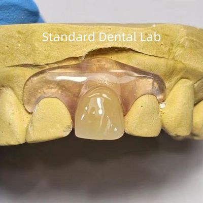 Dental TCS Valplast Flexible Teilpräparate Farbgebung Verwischungsgerüche widerstandsfähig