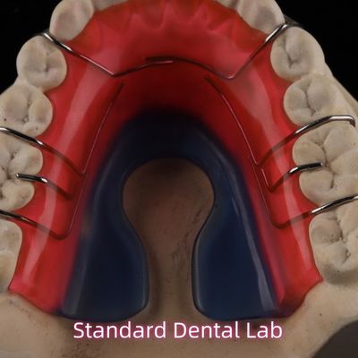 Entfernbares Zahnorthopädisches Gerät Hawley Retainer
