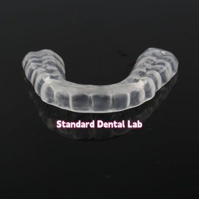 Custom Nacht Zahn Mundschutz Occlusal Splint China Zahnlabor