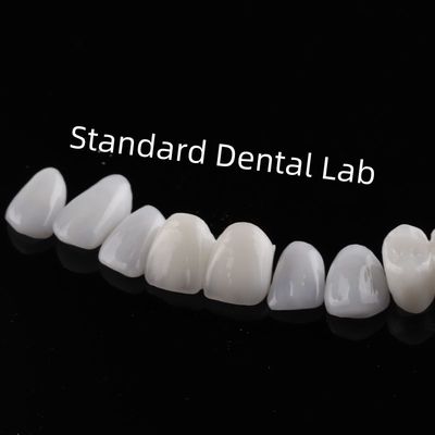 Höchste ästhetische Zähne Emax Laminat Veneers Schnitttransparenz
