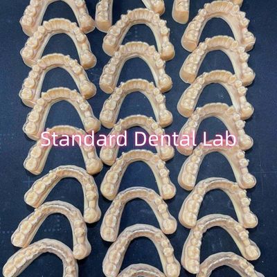 Professionelle Zahnärztliche Orthodontie Invisalign Klarhalter Behandlungsplan