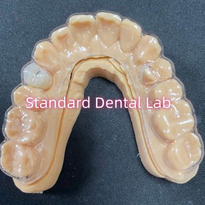 Professionelle orthodontische Behälter Klares Essix Behälter mit stabilen Acrylharz Zähne