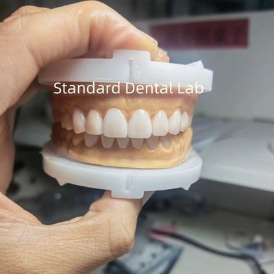 Perfekte Ästhetik Vorläufige Wachs für Zahnärzte mit Zahnwachs aus China Dental Lab