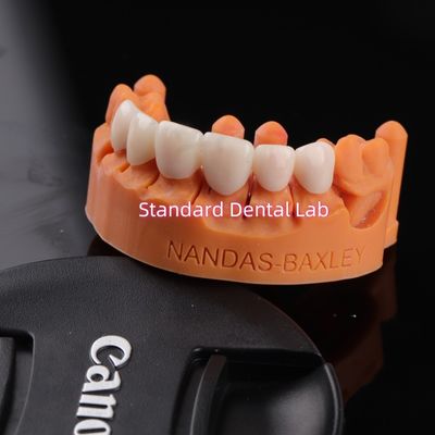 Komfort und Funktionalität mit Digital CAD CAM Dental Lab Durchsichtige Schichtzirkoniebrücke