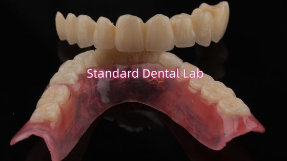 Hochbeständiges und natürlich aussehendes Schichtporzellan für Schichtzähne Zirkonia Krone China Dental Lab