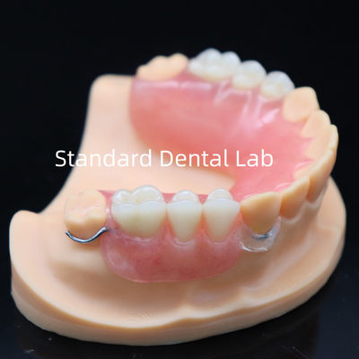 Hohe Ästhetik Acryl-Teilprothesen mit klarem Verschluss und Acrylzähne China Dental Lab