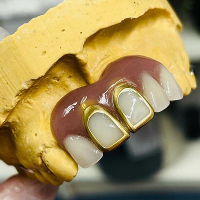 Anpassbares Kobalt-Chrom-Guss-Rahmen mit sehr guten Aufklebern Redo-Richtlinie kostenlos