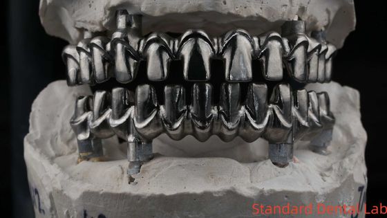 Dental Hybird Malo Implantate Brücke Professional Perfekt Fit FDA zertifiziert
