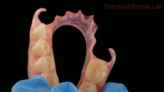 Dental TCS Valplast Flexible Teilpräparate Dentallabor 3D-Druckmodell hohe Ästhetik