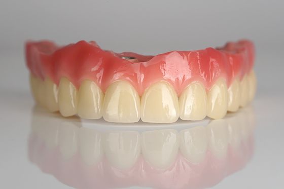 Vollbogen Zirkonia Implantatbrücke All-on-Four / All-on-Six Zahnimplantate Schnelle Genesung