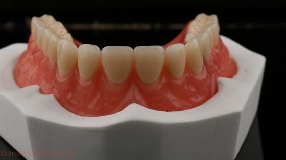 Dentsply Lucitone 199 Acryl-Zahnersatz für einen natürlichen Aussehen
