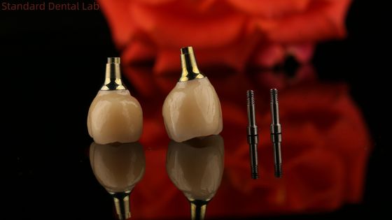 Porzellan Zirkonia Zement Behaltene Schraube Implantat Hexagonalen Kopfform für individuelle Fit Ästhetik