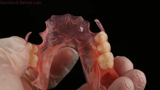 Ace Teeth Rosa/Dunkel TCS Valplast Flexible Teilpräparate für eine hohe Ästhetik Dental 3D Print Modell