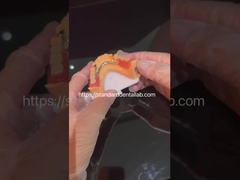 Hohe Ästhetik Acryl-Teilprothesen mit klarem Verschluss und Acrylzähne China Dental Lab