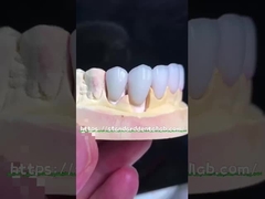 Natürlich aussehende Emax Veneers Krone Biokompatibilität Bleichschatten mit minimaler Vorbereitung