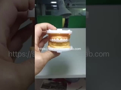 Hochesthetische BruxZir Vollkontur Zirkonia Kronen PFZ Brücke