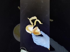 Dentsply Lucitone 199 Acryl-Zahnersatz für einen natürlichen Aussehen