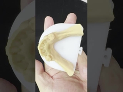 Metalllegierungen Teilweise Kobalt Chrom Zahnersatz Ivoclar Scheftner Komfortable Metallrahmen