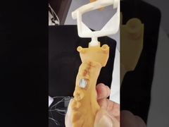 Vollkontur Zirkonia Krone/Hochesthetische natürliche angepasste Aidit Zirkonia Zahnbrücke